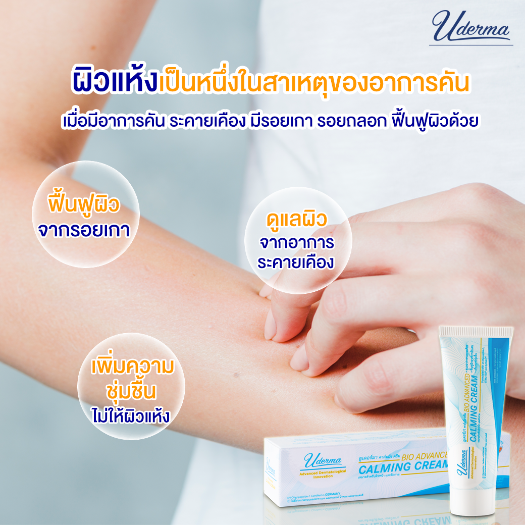 Uderma, Uderma รีวิว, Uderma ราคา, Uderma Bio Advanced Calming Cream, Uderma Bio Advanced Calming Cream รีวิว, Uderma Bio Advanced Calming Cream 25g, Uderma Bio Advanced Calming Cream 25g ครีมปลอบประโลมผิวจากอาการคัน, ครีมปลอบประโลมผิว, Uderma Bio Advanced